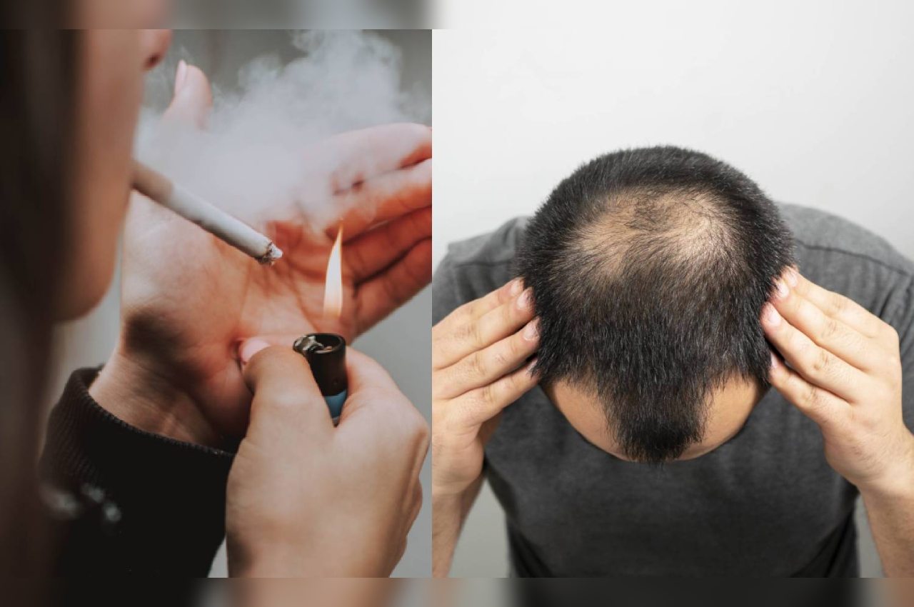 Are You Experiencing Hair Loss? Do You Smoke? Quit Smoking Instantly Using  THIS Oil - News24 English