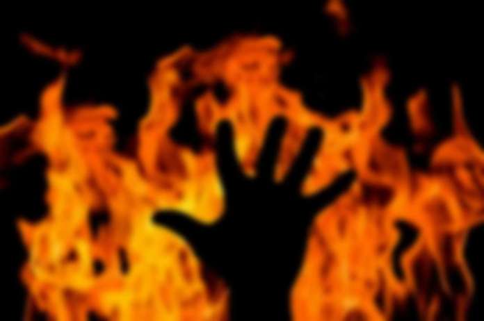 Horrific! One-sided lover pours petrol on girl, burns her after she refuses to talk
