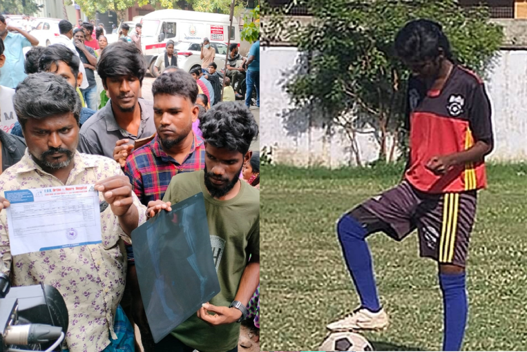 Tamil Nadu: Teen dies of organs failure after botched ligament surgery