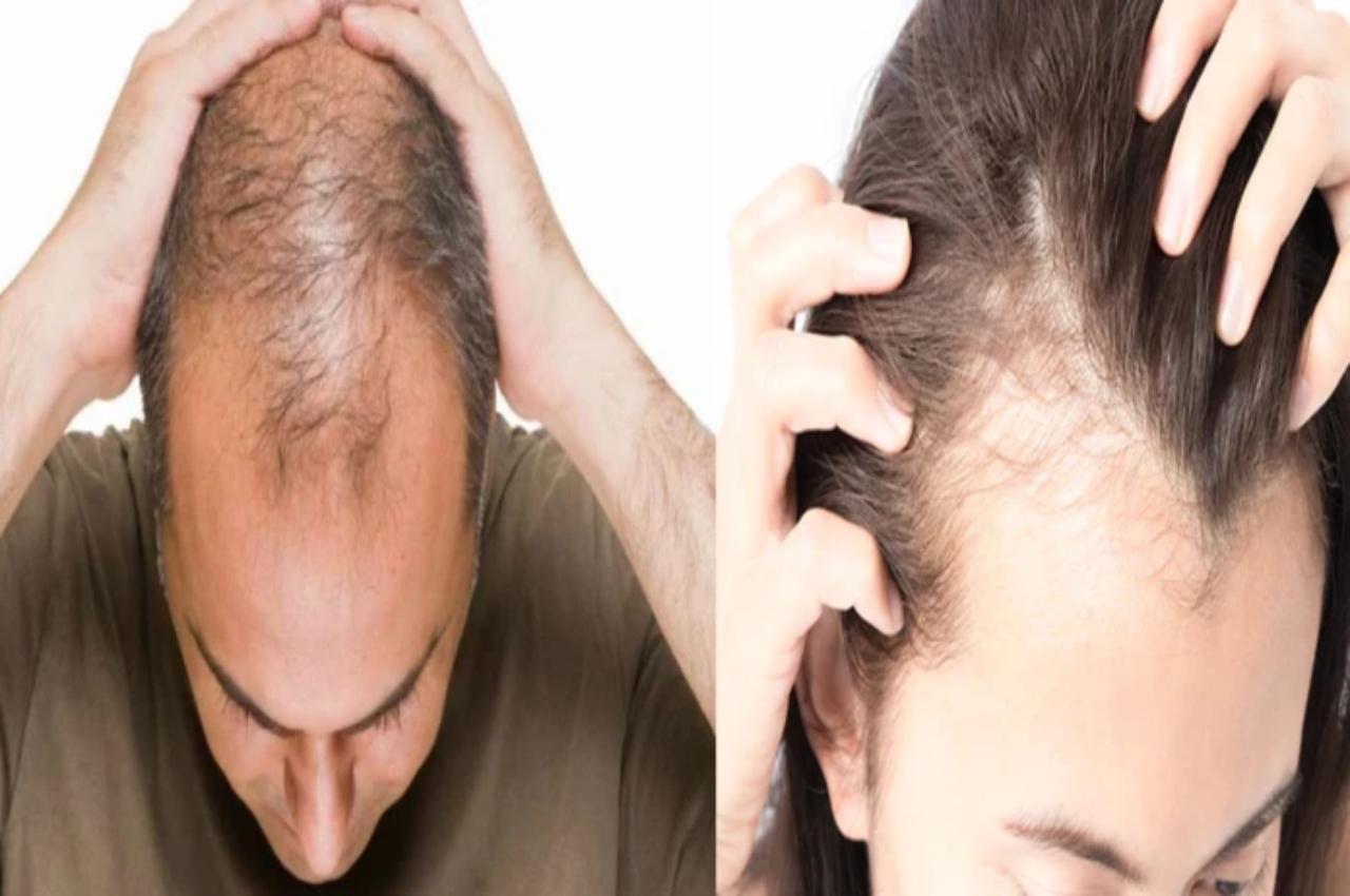 Hair Care TIPS: This coconut oil recipe will get you rid of baldness