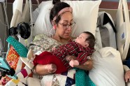 US Woman Loses Her Limbs Post Child Birth Deeds Here