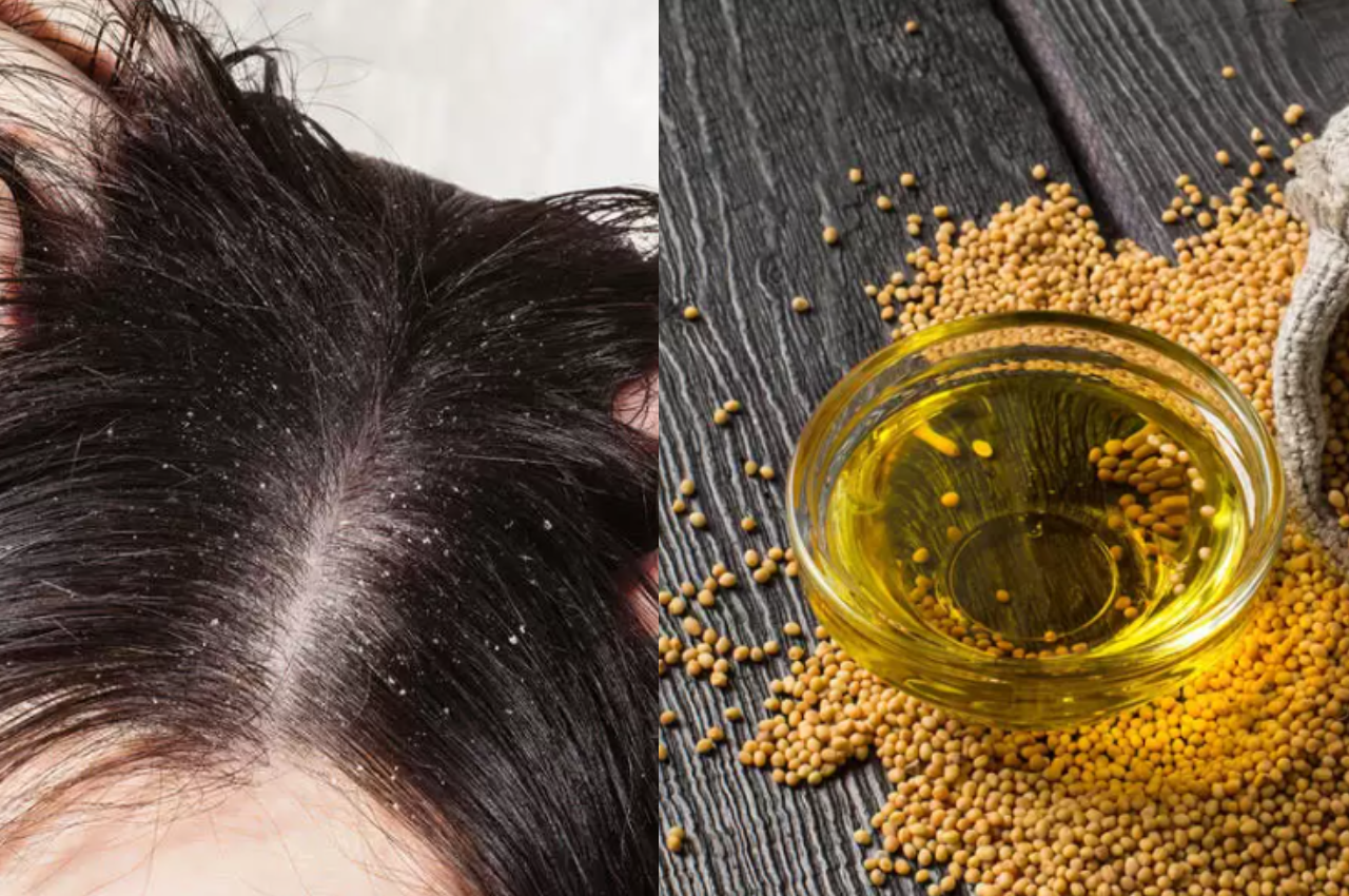 Hair care TIPS: This oil will remove dirt from scalp, check how to...