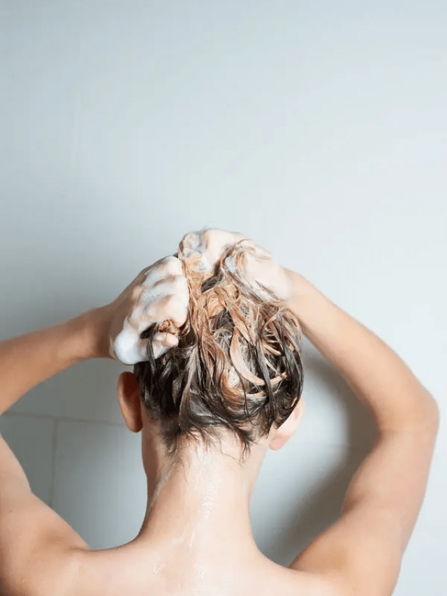 10 best dandruff shampoos