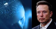 Elon Musk's Naceuralink Brain Implant