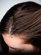 Tips To Deal With Oily Scalp