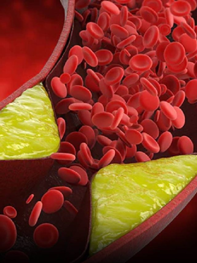 8 Yellow Fruits That Help To Reduce Bad Cholesterol News24