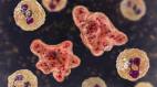 Kerala girl dies off amoeba infection