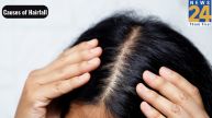 causes of hairfall