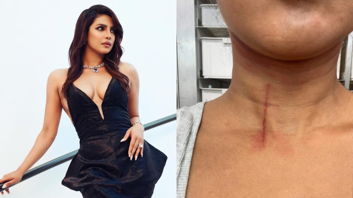 Priyanka Chopra Injured On 'The Bluff' Set Due To Professional Hazard