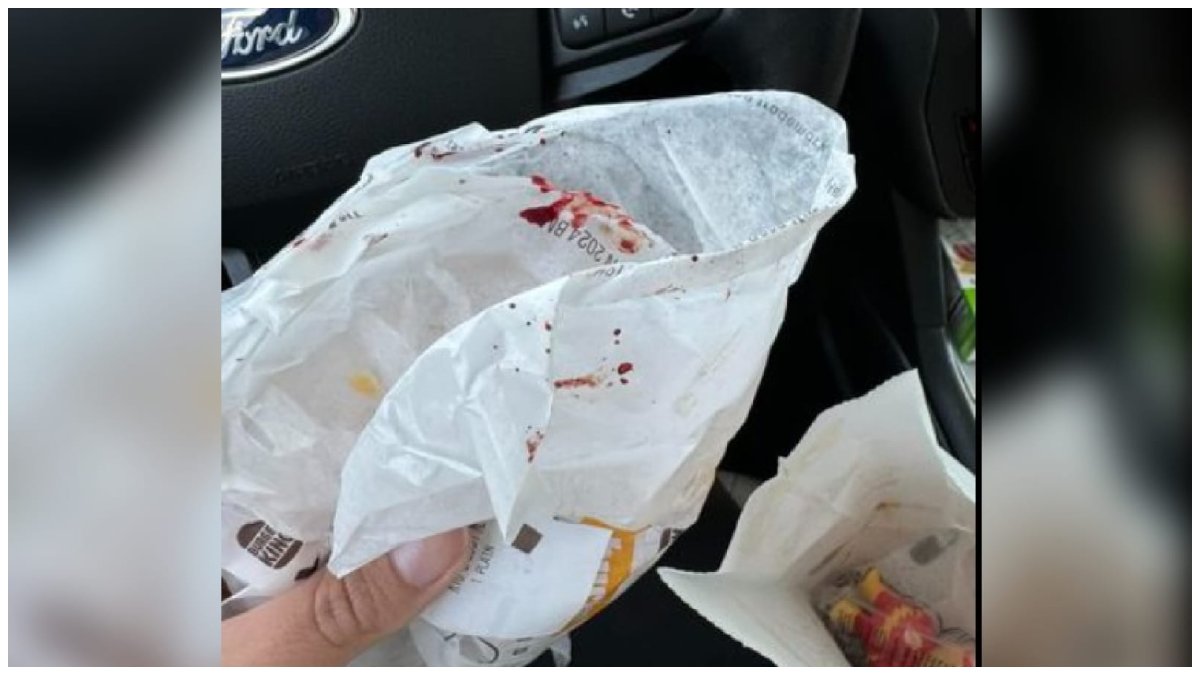 Blood over in Burger King meal packet