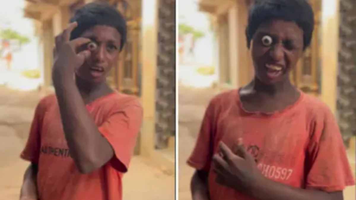 In the world of social media talent showcases, a viral video features a boy seemingly popping his eyeballs out with his hands.