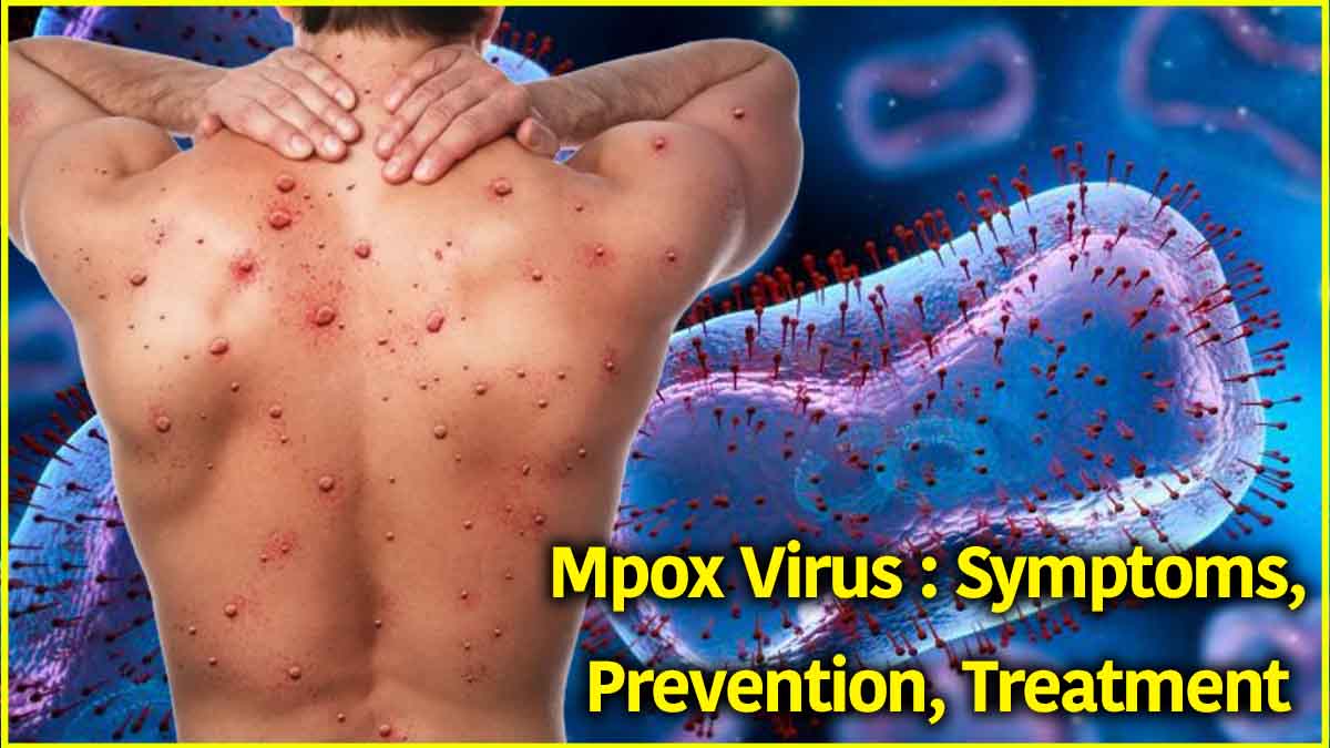 Mpox Virus