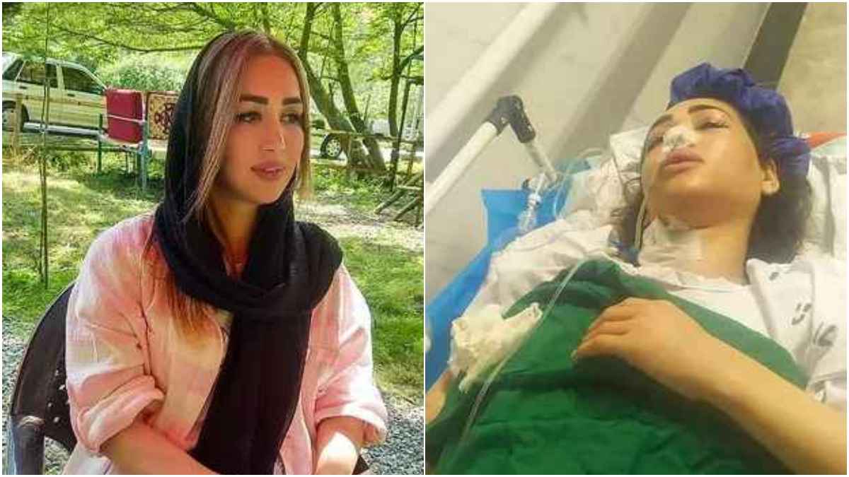 Woman Shot And Left Paralysed By Police For Driving Without Hijab In THIS Country, Read More