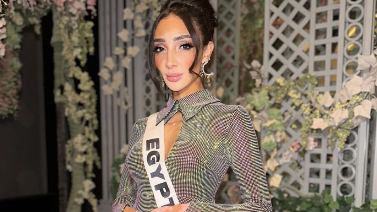 Who is Logina Salah? First Woman With Vitiligo To Contest At Miss Universe