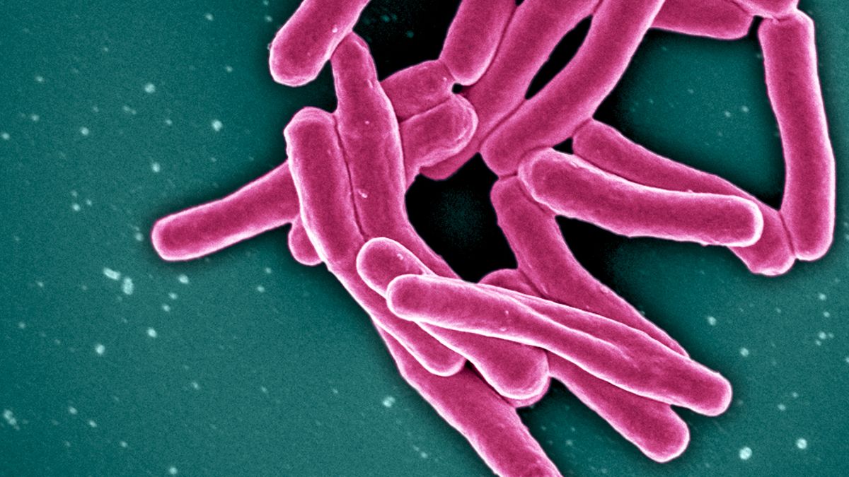 Tuberculosis