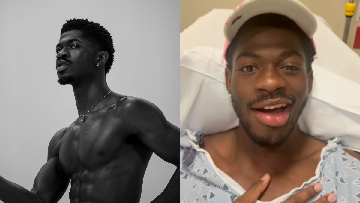 Lil Nas X Opens Up About Facial Paralysis Says, 'When I smile...'