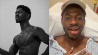 Lil Nas X Opens Up About Facial Paralysis Says, 'When I smile...'
