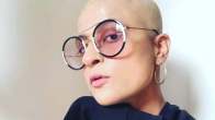 Tahira kashyap Startled By Doctors Choice Of This SRK Song As She Gets Cancer Treatment