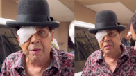 Dharmendra Radiates Strength Post Eye Surgery; Greets Media With A Bandage | VIDEO