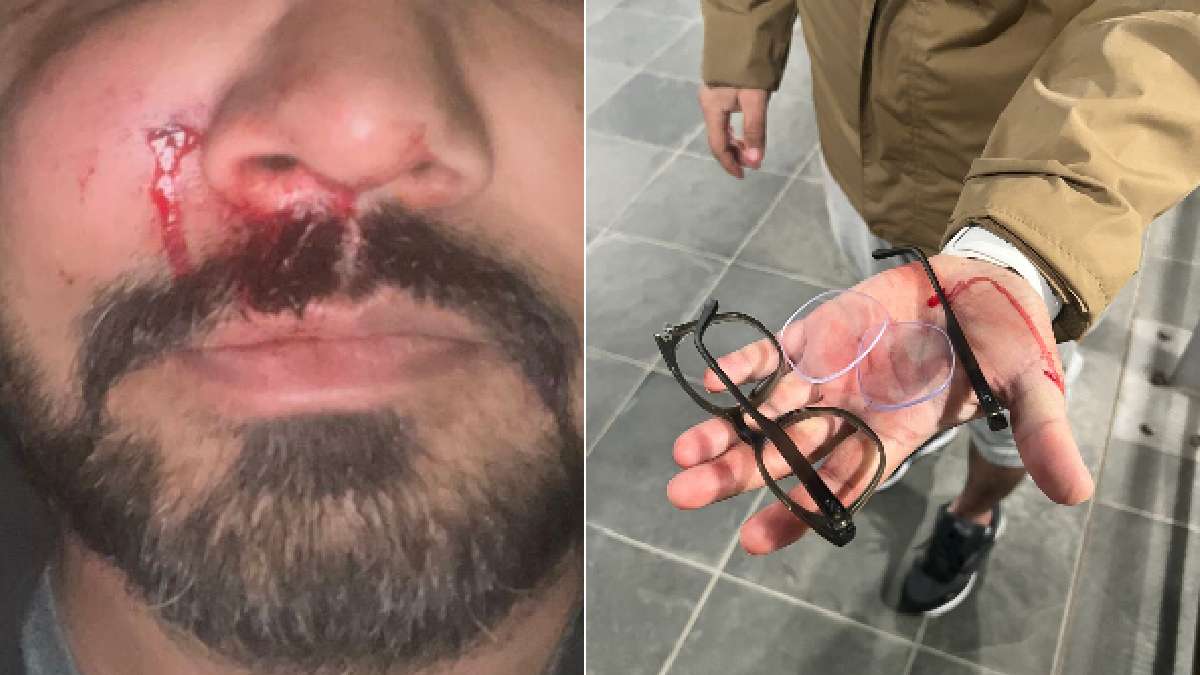 Indian-Origin Data Scientist Brutally Beaten In Ireland