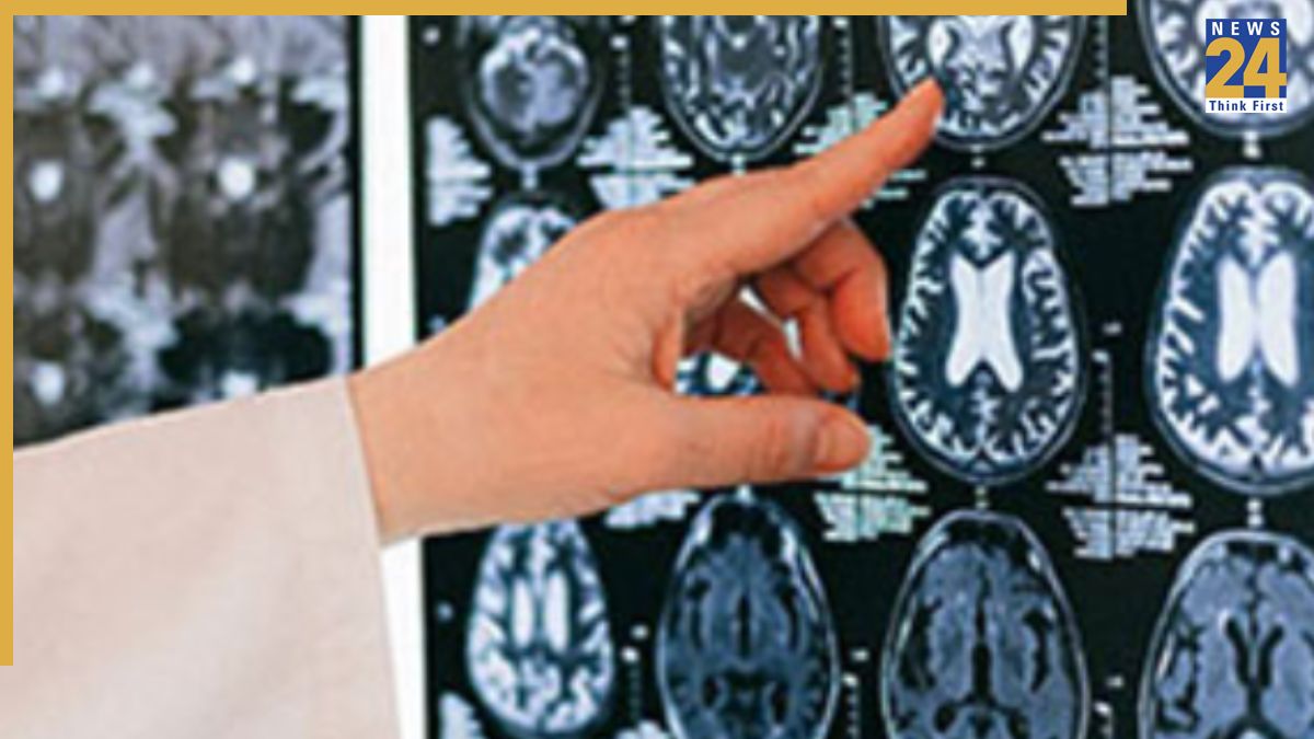 Kerala rare infection