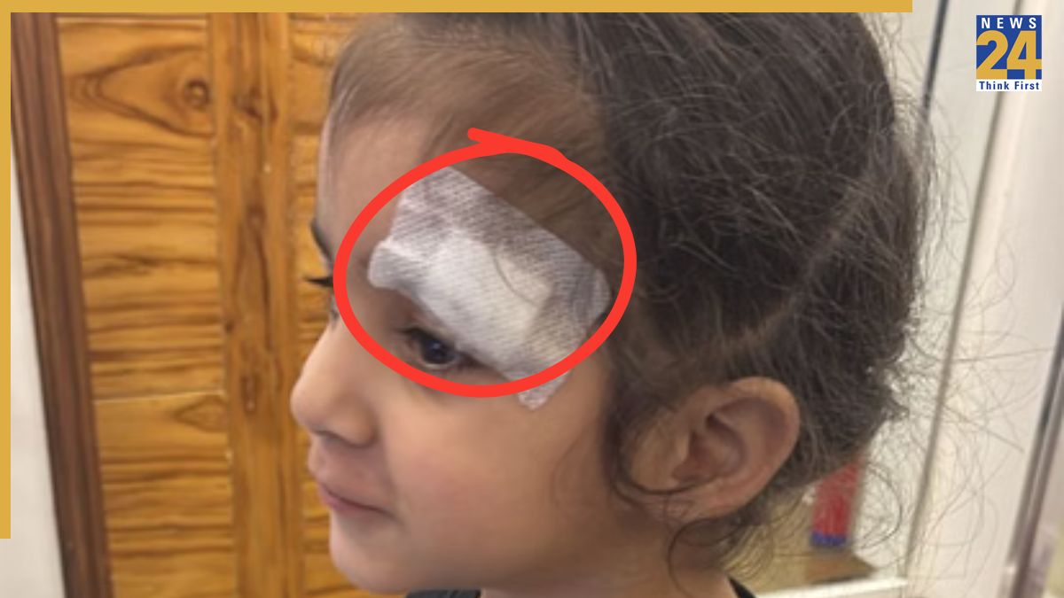 Meerut doctor uses fevikwik on child's wound SHOCKING: Doctor allegedly uses fevikwik for sealing 2-year old child’s head wound instead of stitches