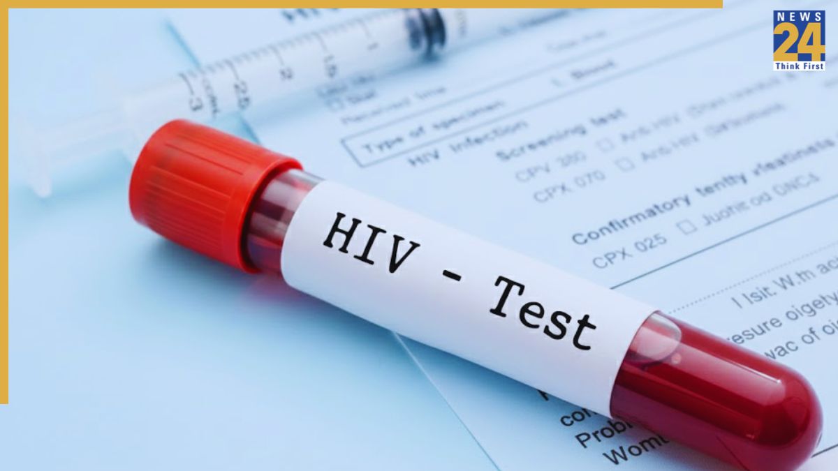 HIV Test