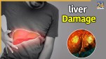 Liver damage