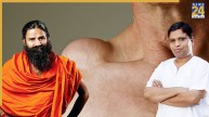 Remedies for Lumps: Acharya Balkrishna and Baba Ramdev share Ayurvedic tips to treat lumps